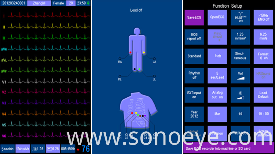 6 Channel electrocardiograph Machine